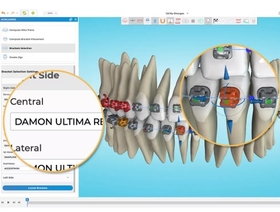 Formation “Bootcamp” sur le système orthodontique Ormco Digital Bonding (ODB)